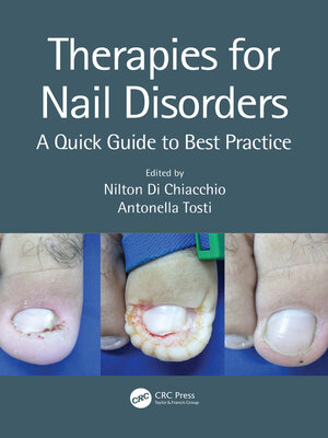 cover image of Therapies for Nail Disorders